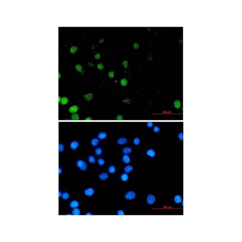 aladdin 阿拉丁 Ab103911 Recombinant FOXA1 Antibody Recombinant (R04-5A7); Rabbit anti Human FOXA1 Antibody; WB, ICC, IF; Unconjugated