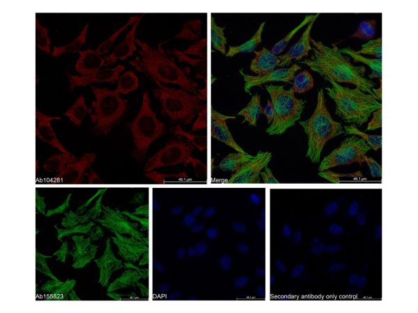aladdin 阿拉丁 Ab104281 Recombinant FXR1 Antibody Recombinant (R03-0I1); Rabbit anti Human FXR1 Antibody; WB, IF, ICC, IHC; Unconjugated