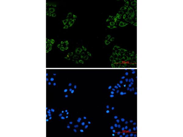 aladdin 阿拉丁 Ab104281 Recombinant FXR1 Antibody Recombinant (R03-0I1); Rabbit anti Human FXR1 Antibody; WB, IF, ICC, IHC; Unconjugated