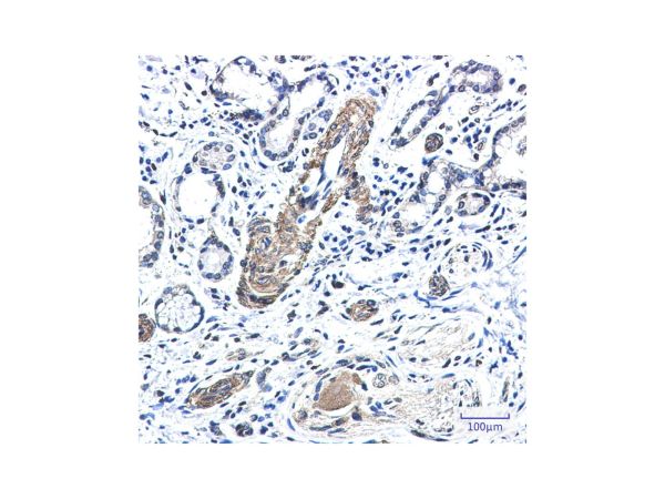 aladdin 阿拉丁 Ab104281 Recombinant FXR1 Antibody Recombinant (R03-0I1); Rabbit anti Human FXR1 Antibody; WB, IF, ICC, IHC; Unconjugated