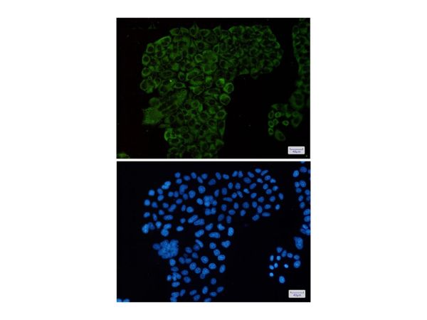 aladdin 阿拉丁 Ab104334 Recombinant G3BP Antibody Recombinant (R06-5D2); Rabbit anti Human G3BP Antibody; WB, ICC, IF, IHC; Unconjugated