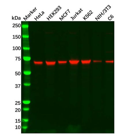 aladdin 阿拉丁 Ab104489 Recombinant GAD67 Antibody Recombinant (R06-2D9); Rabbit anti Human GAD67 Antibody; WB; Unconjugated