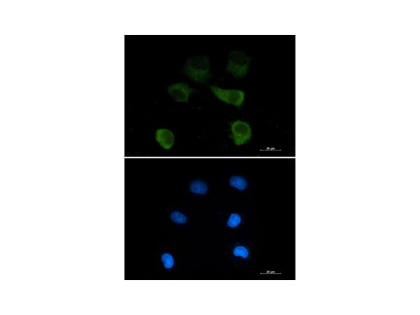 aladdin 阿拉丁 Ab104713 Recombinant gamma Tubulin Antibody Recombinant (R06-6A6); Rabbit anti Human gamma Tubulin Antibody; WB, ICC, IF; Unconjugated