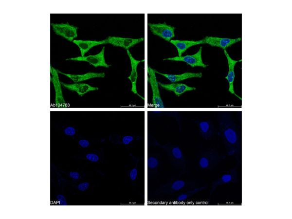 aladdin 阿拉丁 Ab104788 Recombinant GAPDH Antibody Recombinant (RR688); Rabbit anti Human GAPDH Antibody; WB, IHC, Flow, IF, ICC, IP; Unconjugated