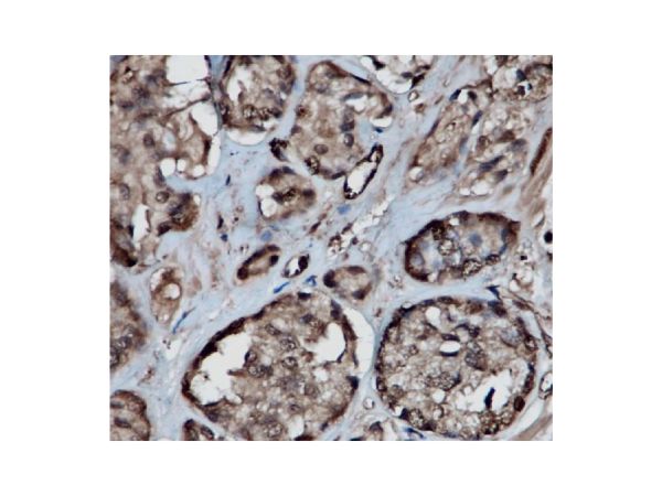 aladdin 阿拉丁 Ab104788 Recombinant GAPDH Antibody Recombinant (RR688); Rabbit anti Human GAPDH Antibody; WB, IHC, Flow, IF, ICC, IP; Unconjugated