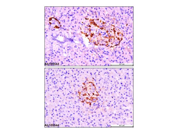 aladdin 阿拉丁 Ab105544 Recombinant Glucagon Antibody Recombinant (EP3070); Rabbit anti Human Glucagon Antibody; IHC; Unconjugated