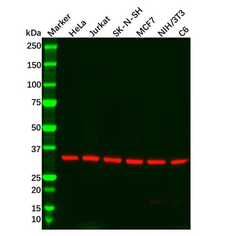 aladdin 阿拉丁 Ab105941 Recombinant GNB2 Antibody Recombinant (R04-1A2); Rabbit anti Human GNB2 Antibody; WB, IHC; Unconjugated