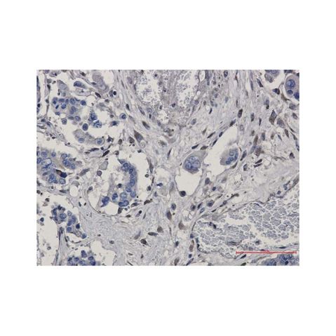 aladdin 阿拉丁 Ab105941 Recombinant GNB2 Antibody Recombinant (R04-1A2); Rabbit anti Human GNB2 Antibody; WB, IHC; Unconjugated