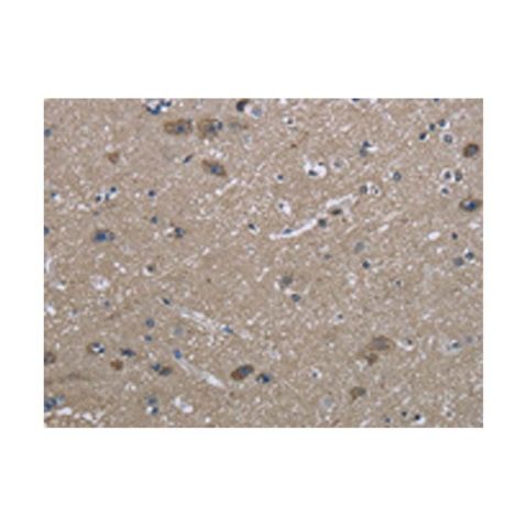 aladdin 阿拉丁 Ab106524 Grp75 Antibody pAb; Rabbit anti Human Grp75 Antibody; WB, IHC; Unconjugated