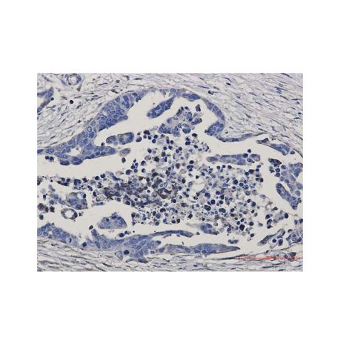 aladdin 阿拉丁 Ab106628 Recombinant GSK3 beta Antibody Recombinant (R09-7G8); Rabbit anti Human GSK3 beta Antibody; WB, IHC; Unconjugated