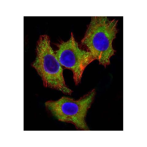 aladdin 阿拉丁 Ab106982 Hck Mouse mAb mAb (1508CT602.13.1); Mouse anti Human Hck Antibody; WB, ICC, IF; Unconjugated