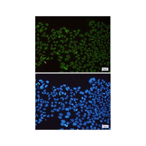 aladdin 阿拉丁 Ab107031 Recombinant HDAC2 Antibody Recombinant (R06-4E4); Rabbit anti Human HDAC2 Antibody; WB, IHC, IF, ICC; Unconjugated