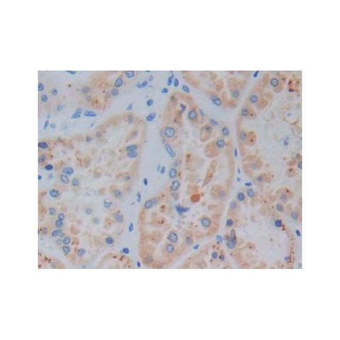 aladdin 阿拉丁 Ab107173 Heme Oxygenase 1 Mouse mAb mAb (A4); Mouse anti Human Heme Oxygenase 1 Antibody; WB, IHC; Unconjugated