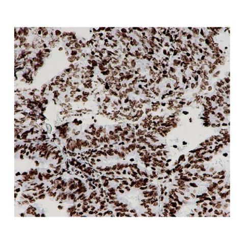 aladdin 阿拉丁 Ab107980 Recombinant Histone H3 Antibody Recombinant (RR692); Rabbit anti Human Histone H3 Antibody; WB, IHC, Flow, IP; Unconjugated