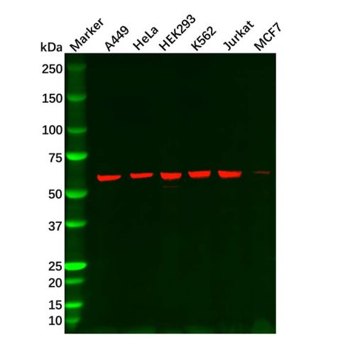 aladdin 阿拉丁 Ab108868 Hsp60 Mouse mAb mAb (C9); Mouse anti Human Hsp60 Antibody; WB; Unconjugated