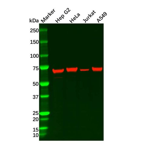 aladdin 阿拉丁 Ab108897 Hsp70 Mouse mAb mAb (2#); Mouse anti Human Hsp70 Antibody; WB, IHC, ICC, IF; Unconjugated