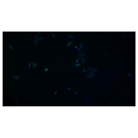 aladdin 阿拉丁 Ab108897 Hsp70 Mouse mAb mAb (2#); Mouse anti Human Hsp70 Antibody; WB, IHC, ICC, IF; Unconjugated