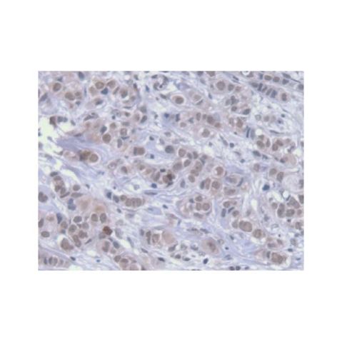 aladdin 阿拉丁 Ab108897 Hsp70 Mouse mAb mAb (2#); Mouse anti Human Hsp70 Antibody; WB, IHC, ICC, IF; Unconjugated