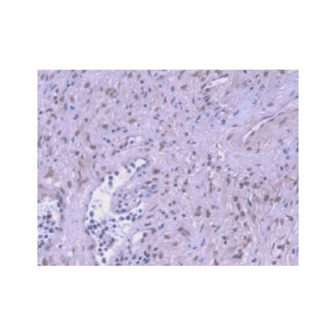 aladdin 阿拉丁 Ab108897 Hsp70 Mouse mAb mAb (2#); Mouse anti Human Hsp70 Antibody; WB, IHC, ICC, IF; Unconjugated