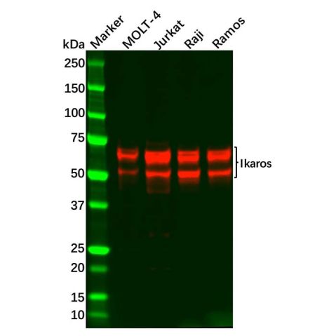 aladdin 阿拉丁 Ab109672 Ikaros Antibody pAb; Rabbit anti Human Ikaros Antibody; WB; Unconjugated