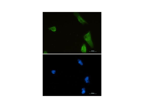 aladdin 阿拉丁 Ab109731 Recombinant IKK beta Antibody Recombinant (R01-9H6); Rabbit anti Human IKK Beta Antibody; WB, ICC, IF; Unconjugated
