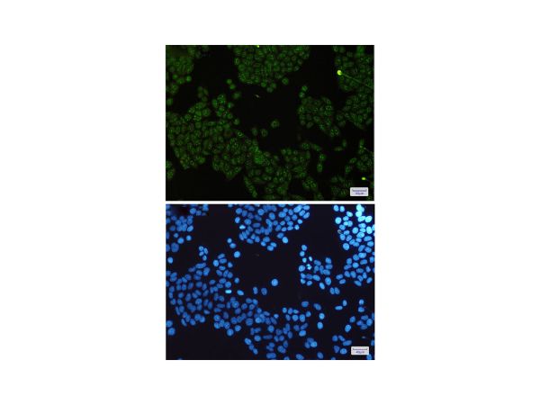aladdin 阿拉丁 Ab109740 Recombinant IKK Gamma/NEMO Antibody Recombinant (R06-5G4); Rabbit anti Human IKK Gamma/NEMO Antibody; WB, ICC, IF; Unconjugated