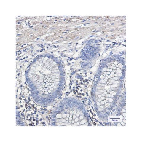 aladdin 阿拉丁 Ab109850 Recombinant IL-11RA Antibody Recombinant (R08-2J3); Rabbit anti Human IL-11RA Antibody; WB, IHC; Unconjugated
