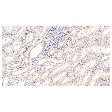 aladdin 阿拉丁 Ab110010 IL-18 Mouse mAb mAb (C10); Mouse anti Human IL-18 Antibody; WB, IHC; Unconjugated