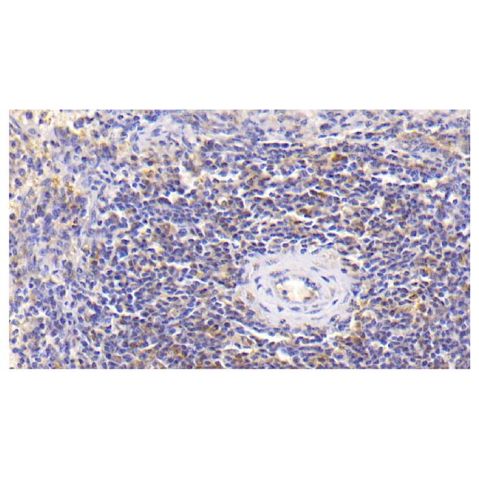 aladdin 阿拉丁 Ab110010 IL-18 Mouse mAb mAb (C10); Mouse anti Human IL-18 Antibody; WB, IHC; Unconjugated