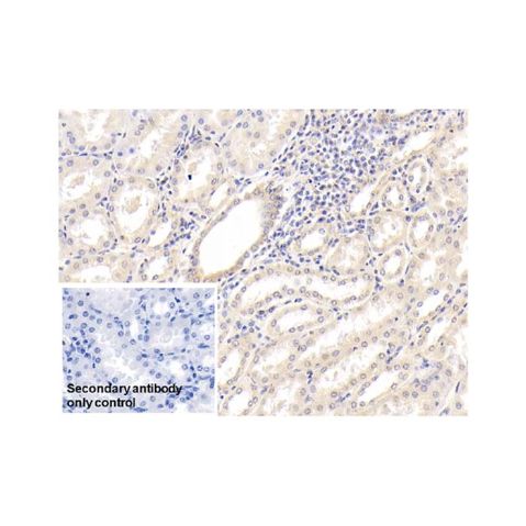 aladdin 阿拉丁 Ab110010 IL-18 Mouse mAb mAb (C10); Mouse anti Human IL-18 Antibody; WB, IHC; Unconjugated