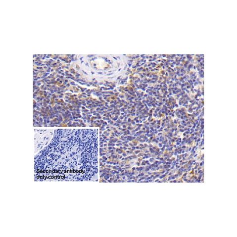 aladdin 阿拉丁 Ab110010 IL-18 Mouse mAb mAb (C10); Mouse anti Human IL-18 Antibody; WB, IHC; Unconjugated