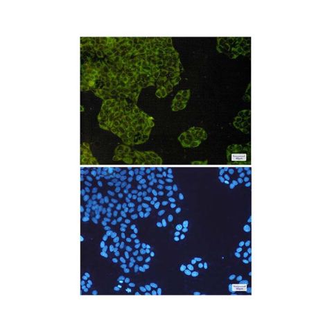 aladdin 阿拉丁 Ab110488 Recombinant IMP3 Antibody Recombinant (R04-7F2); Rabbit anti Human IMP3 Antibody; WB, ICC, IF; Unconjugated