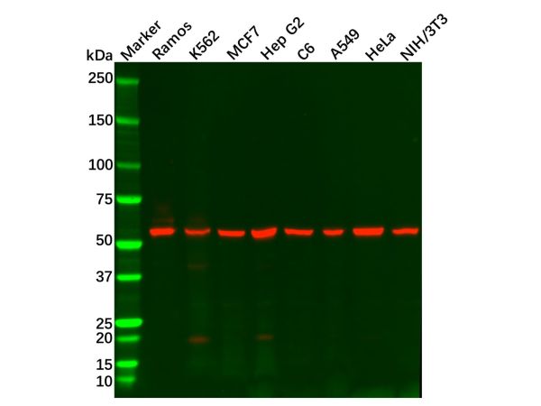 aladdin 阿拉丁 Ab110516 Recombinant IMPDH2 Antibody Recombinant (R06-1B8); Rabbit anti Human IMPDH2 Antibody; WB, IHC, ICC, IF; Unconjugated
