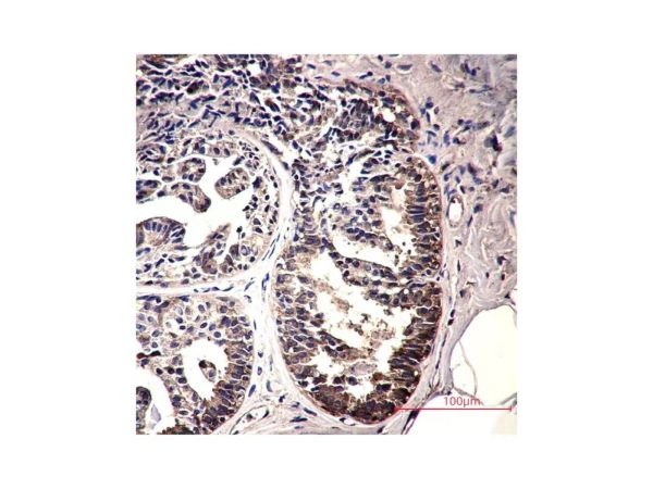 aladdin 阿拉丁 Ab110516 Recombinant IMPDH2 Antibody Recombinant (R06-1B8); Rabbit anti Human IMPDH2 Antibody; WB, IHC, ICC, IF; Unconjugated