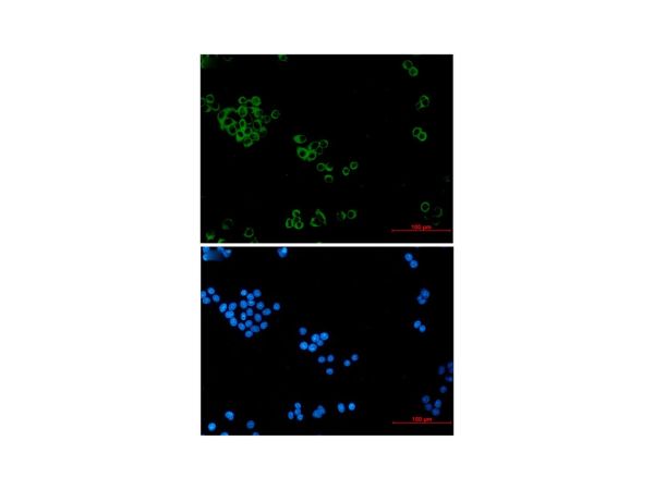 aladdin 阿拉丁 Ab110516 Recombinant IMPDH2 Antibody Recombinant (R06-1B8); Rabbit anti Human IMPDH2 Antibody; WB, IHC, ICC, IF; Unconjugated