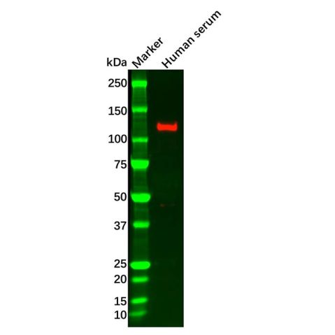aladdin 阿拉丁 Ab110648 iNOS Mouse mAb mAb (C1); Mouse anti Human iNOS Antibody; WB, IHC; Unconjugated