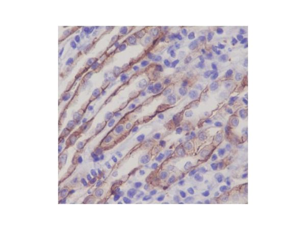 aladdin 阿拉丁 Ab110755 Recombinant Integrin alpha 2 Antibody Recombinant (R09-7C3); Rabbit anti Human Integrin alpha 2 Antibody; WB, IHC; Unconjugated