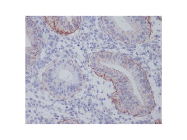 aladdin 阿拉丁 Ab110811 Recombinant Integrin alpha 6 Antibody Recombinant (R01-6B2); Rabbit anti Human Integrin alpha 6 Antibody; WB, IHC; 