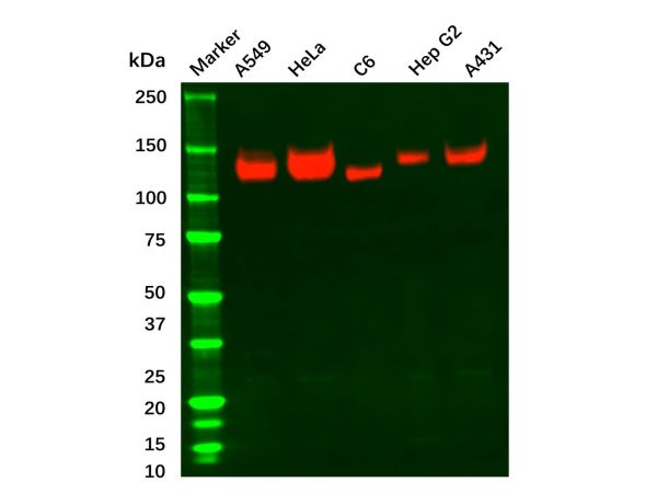 aladdin 阿拉丁 Ab110825 Recombinant Integrin alpha V Antibody Recombinant (R02-6G3); Rabbit anti Human Integrin Alpha V Antibody; WB, ICC, IF; Unconjugated