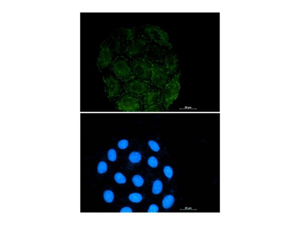 aladdin 阿拉丁 Ab110825 Recombinant Integrin alpha V Antibody Recombinant (R02-6G3); Rabbit anti Human Integrin Alpha V Antibody; WB, ICC, IF; Unconjugated