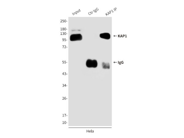 aladdin 阿拉丁 Ab111687 KAP1 Mouse mAb mAb(4E1-D12-F8); Mouse anti Human KAP1 Antibody; WB, IHC-F, IHC-P, ICC/IF, IP; Unconjugated