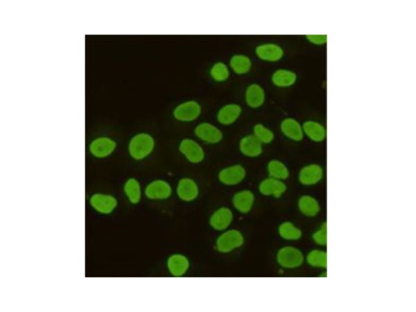 aladdin 阿拉丁 Ab111687 KAP1 Mouse mAb mAb(4E1-D12-F8); Mouse anti Human KAP1 Antibody; WB, IHC-F, IHC-P, ICC/IF, IP; Unconjugated