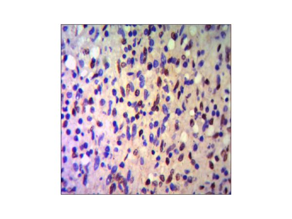 aladdin 阿拉丁 Ab111687 KAP1 Mouse mAb mAb(4E1-D12-F8); Mouse anti Human KAP1 Antibody; WB, IHC-F, IHC-P, ICC/IF, IP; Unconjugated