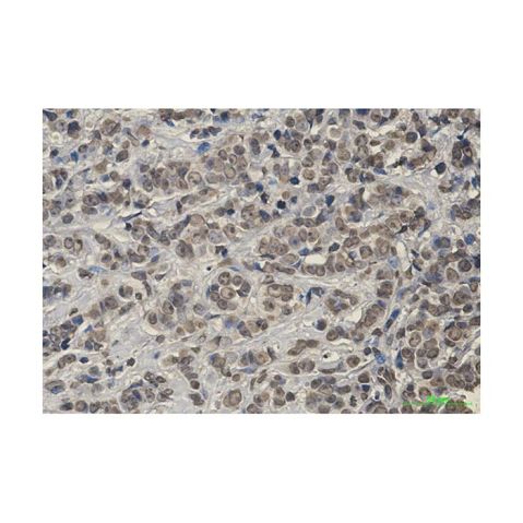 aladdin 阿拉丁 Ab111970 Recombinant Keap1 Antibody Recombinant (R02-1H7); Rabbit anti Human Keap1 Antibody; WB, IHC; Unconjugated