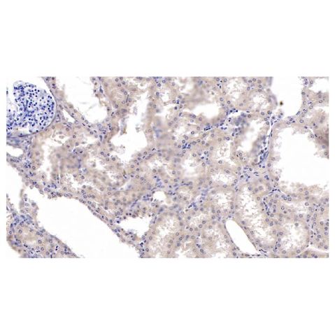aladdin 阿拉丁 Ab112361 KPNA2 Mouse mAb mAb(C8); Mouse anti Human KPNA2 Antibody; WB, IHC; Unconjugated