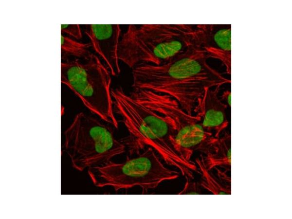 aladdin 阿拉丁 Ab112438 Ku80 Mouse mAb mAb (5C5); Mouse anti Human Ku80 Antibody; WB, ELISA, IHC, Flow, IF, ICC; Unconjugated