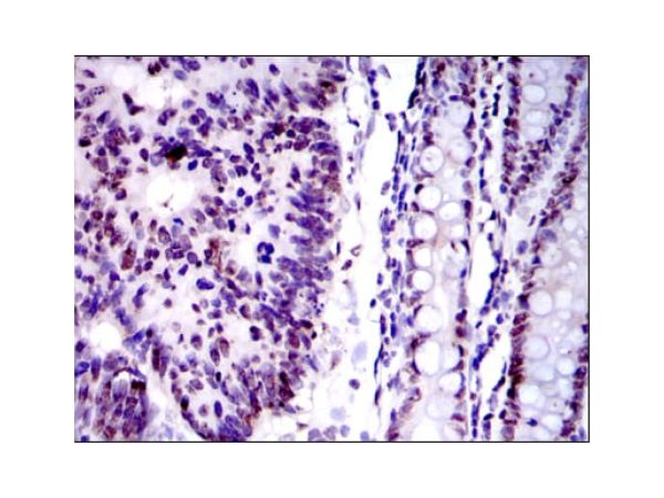 aladdin 阿拉丁 Ab112438 Ku80 Mouse mAb mAb (5C5); Mouse anti Human Ku80 Antibody; WB, ELISA, IHC, Flow, IF, ICC; Unconjugated