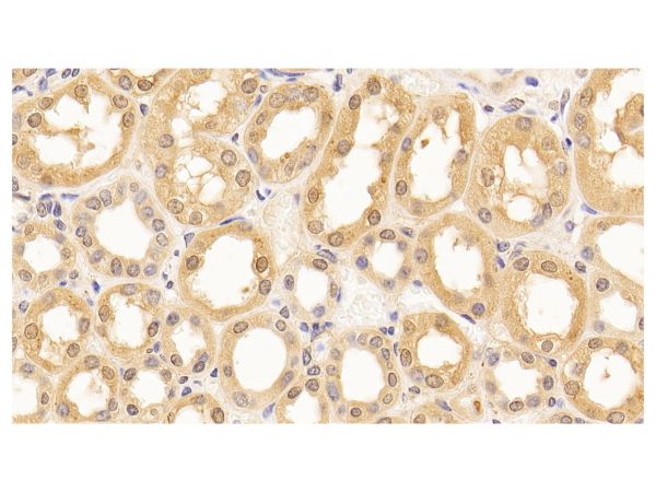 aladdin 阿拉丁 Ab112658 Lamin B1 Mouse mAb mAb (C2); Mouse anti Human Lamin B1 Antibody; WB, IHC; Unconjugated