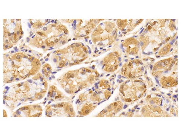 aladdin 阿拉丁 Ab112658 Lamin B1 Mouse mAb mAb (C2); Mouse anti Human Lamin B1 Antibody; WB, IHC; Unconjugated