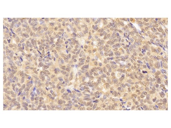 aladdin 阿拉丁 Ab112658 Lamin B1 Mouse mAb mAb (C2); Mouse anti Human Lamin B1 Antibody; WB, IHC; Unconjugated